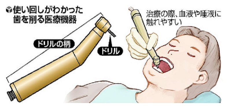 歯を削る機器7割の歯科医院で使いまわし問題